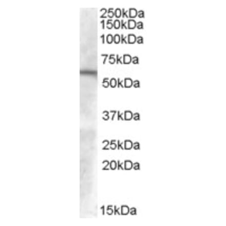 Western Blot - Anti-GCNT3 Antibody (A84449) - Antibodies.com