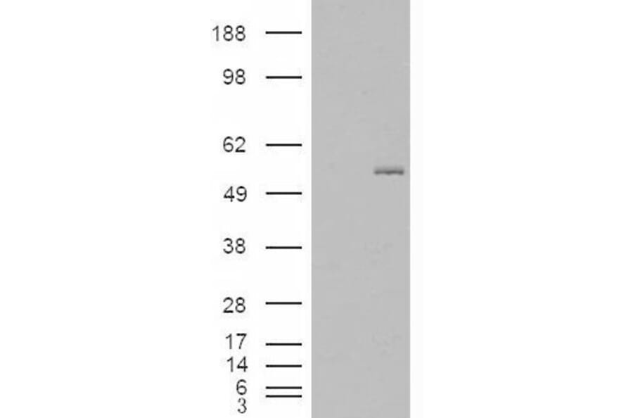 Western Blot - Anti-GCNT3 Antibody (A84449) - Antibodies.com