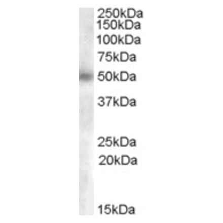 Western Blot - Anti-GCNT3 Antibody (A84450) - Antibodies.com