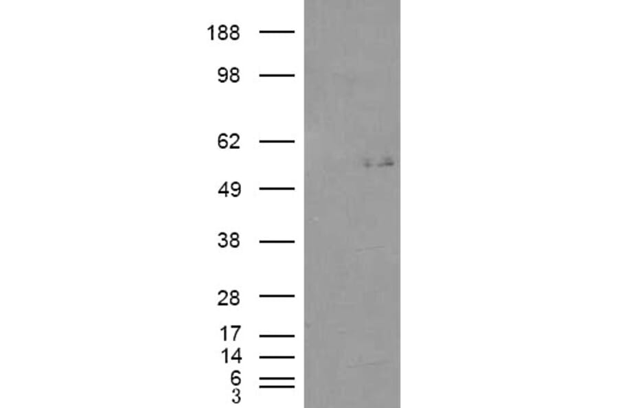 Western Blot - Anti-GCNT3 Antibody (A84450) - Antibodies.com
