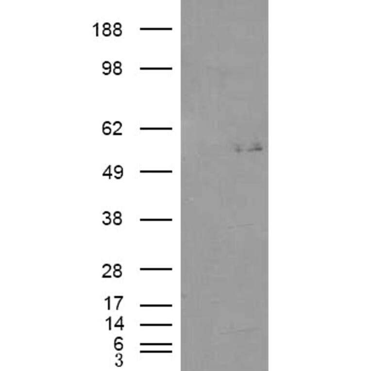 Western Blot - Anti-GCNT3 Antibody (A84450) - Antibodies.com