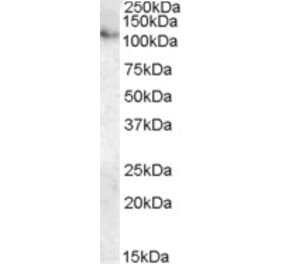 Western Blot - Anti-ATP13A1 Antibody (A84451) - Antibodies.com