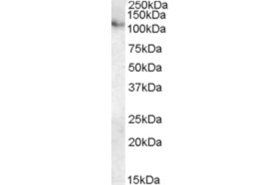 Western Blot - Anti-ATP13A1 Antibody (A84451) - Antibodies.com