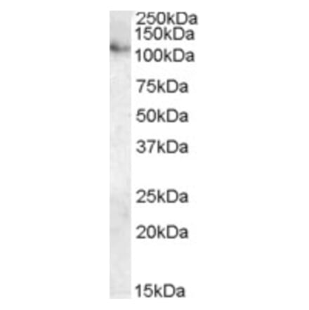 Western Blot - Anti-ATP13A1 Antibody (A84451) - Antibodies.com