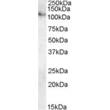 Western Blot - Anti-ATP13A1 Antibody (A84451) - Antibodies.com