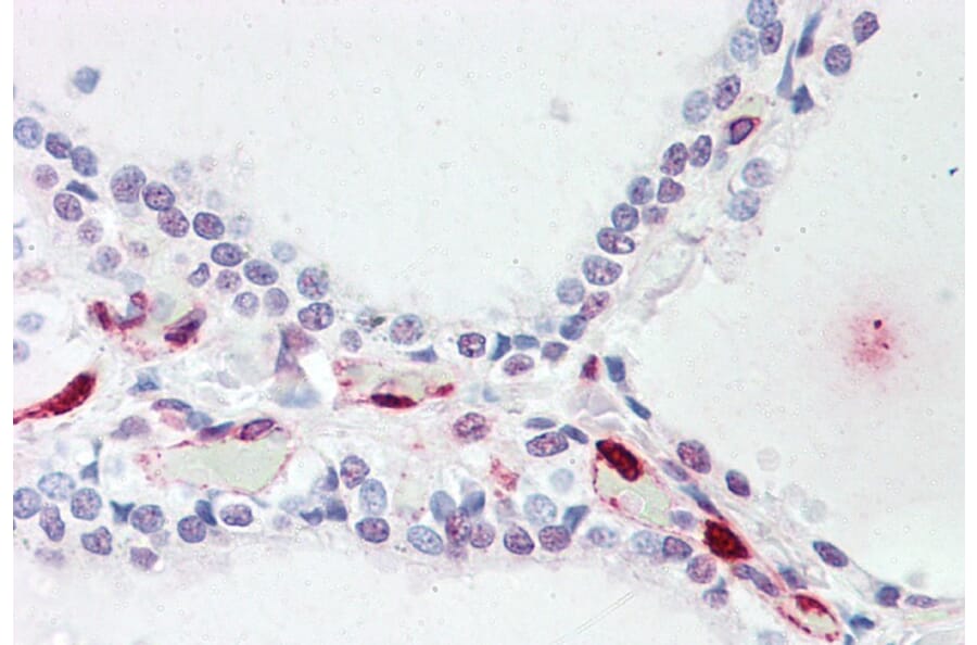 Immunohistochemistry - Anti-ATP13A1 Antibody (A84451) - Antibodies.com