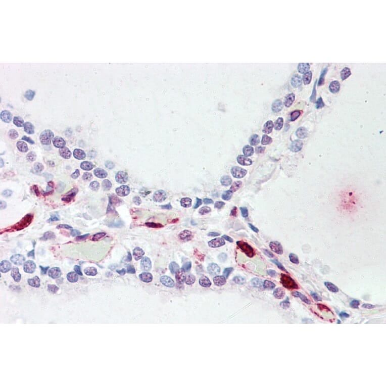 Immunohistochemistry - Anti-ATP13A1 Antibody (A84451) - Antibodies.com