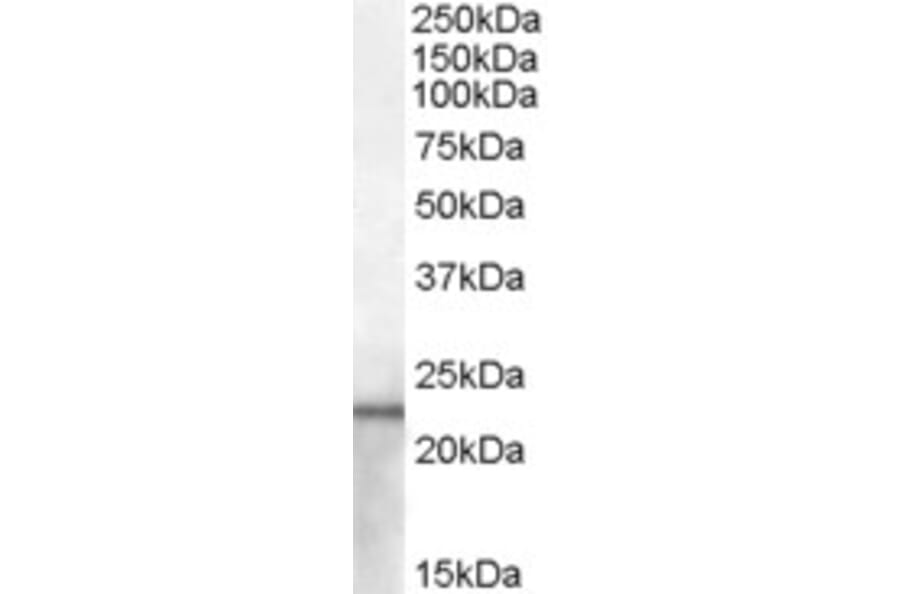 Western Blot - Anti-Lipocalin-2/NGAL Antibody (A84452) - Antibodies.com