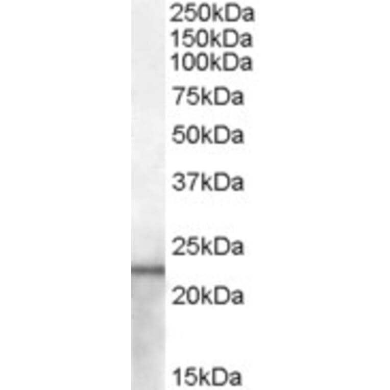 Western Blot - Anti-Lipocalin-2/NGAL Antibody (A84452) - Antibodies.com