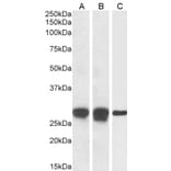Western Blot - Anti-APOBEC3A Antibody (A84453) - Antibodies.com