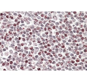 Immunohistochemistry - Anti-APOBEC3A Antibody (A84453) - Antibodies.com