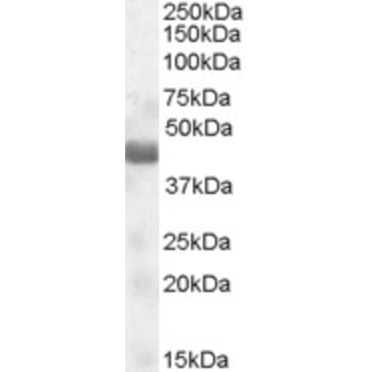 Western Blot - Anti-NPRL2 Antibody (A84454) - Antibodies.com