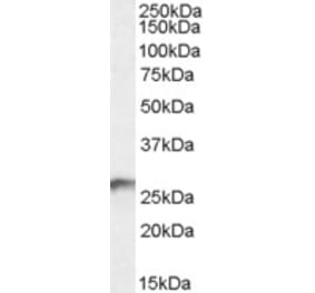 Western Blot - Anti-BDH2 Antibody (A84456) - Antibodies.com