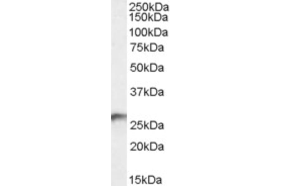 Western Blot - Anti-BDH2 Antibody (A84456) - Antibodies.com