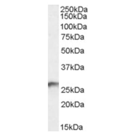 Western Blot - Anti-BDH2 Antibody (A84456) - Antibodies.com