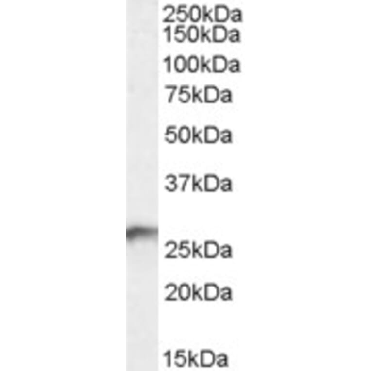 Western Blot - Anti-BDH2 Antibody (A84456) - Antibodies.com