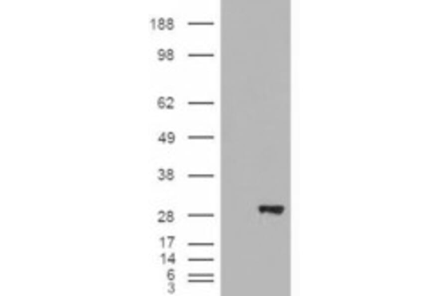 Western Blot - Anti-BDH2 Antibody (A84456) - Antibodies.com
