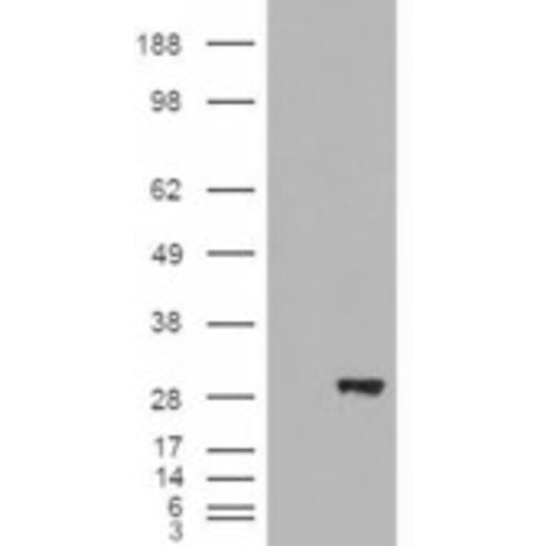 Western Blot - Anti-BDH2 Antibody (A84456) - Antibodies.com