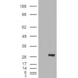 Western Blot - Anti-BDH2 Antibody (A84456) - Antibodies.com