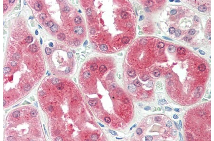Immunohistochemistry - Anti-BDH2 Antibody (A84456) - Antibodies.com