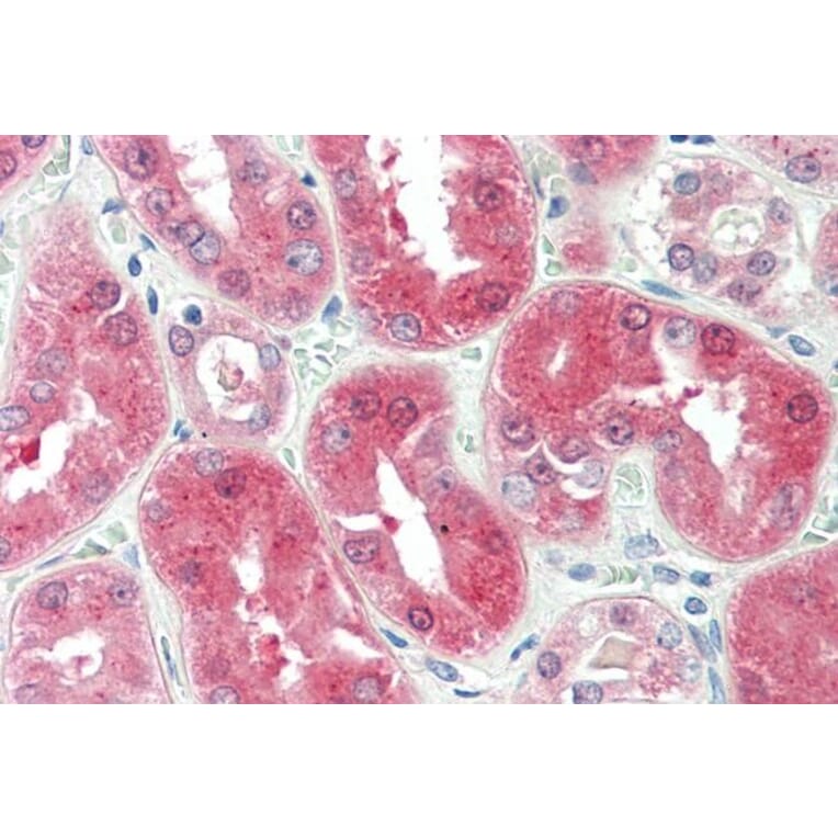 Immunohistochemistry - Anti-BDH2 Antibody (A84456) - Antibodies.com