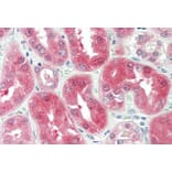 Immunohistochemistry - Anti-BDH2 Antibody (A84456) - Antibodies.com