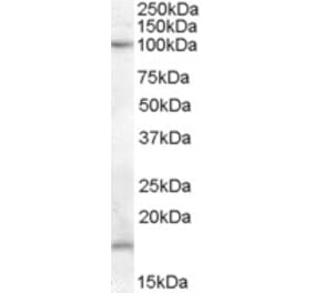 Western Blot - Anti-MARCH6 Antibody (A84458) - Antibodies.com
