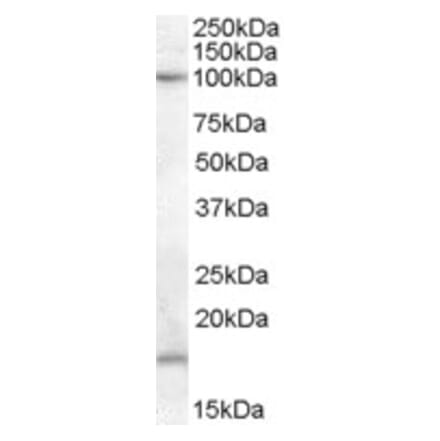 Western Blot - Anti-MARCH6 Antibody (A84458) - Antibodies.com