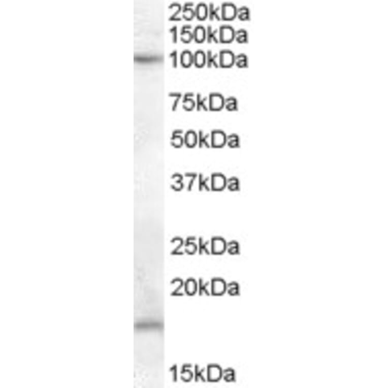 Western Blot - Anti-MARCH6 Antibody (A84458) - Antibodies.com