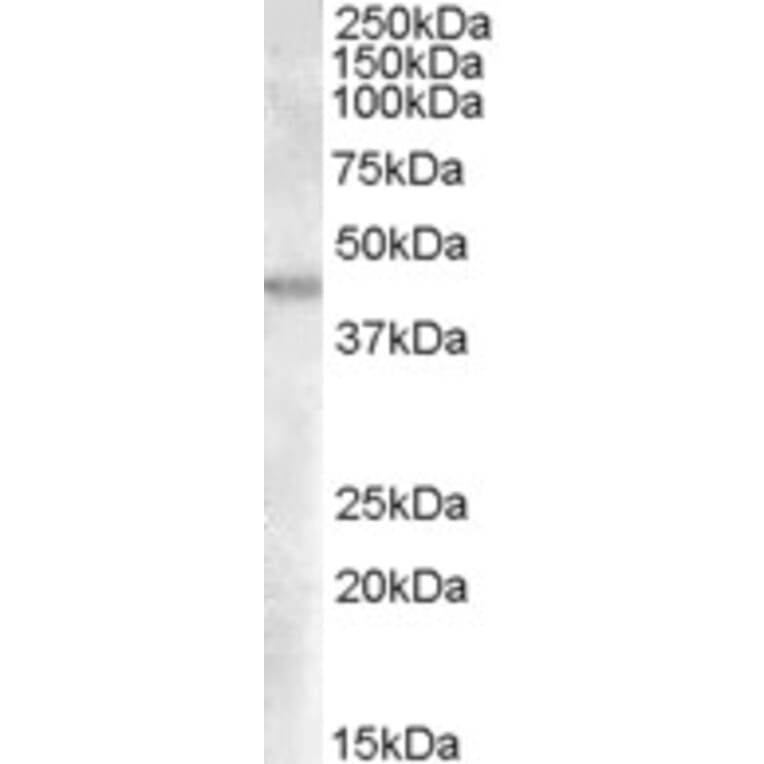 Western Blot - Anti-FABP-1 Antibody (A84459) - Antibodies.com