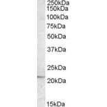Western Blot - Anti-APOBEC3C/PBI Antibody (A84461) - Antibodies.com