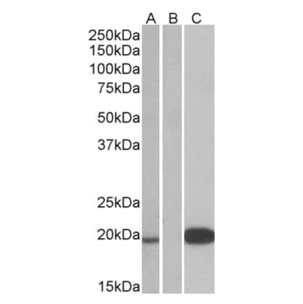 Western Blot - Anti-Urocortin 3 Antibody (A84462) - Antibodies.com