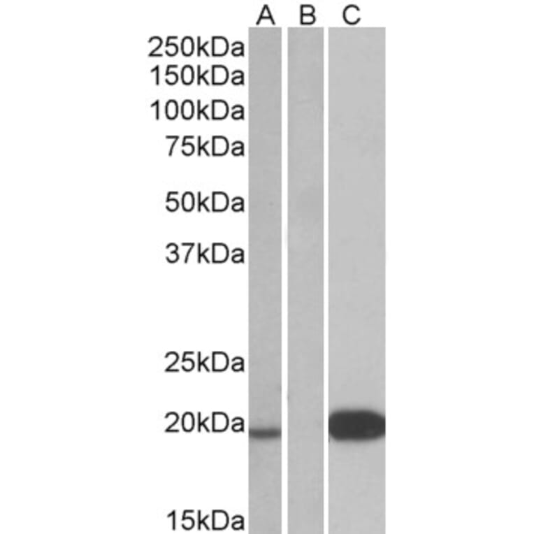 Western Blot - Anti-Urocortin 3 Antibody (A84462) - Antibodies.com