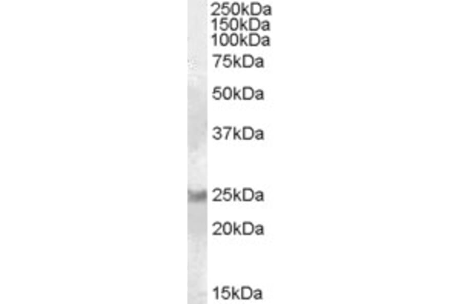 Western Blot - Anti-RAB8A Antibody (A84463) - Antibodies.com