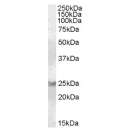 Western Blot - Anti-RAB8A Antibody (A84463) - Antibodies.com