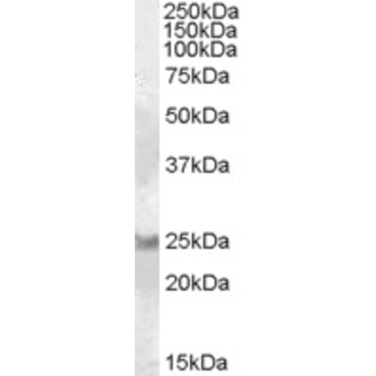 Western Blot - Anti-RAB8A Antibody (A84463) - Antibodies.com