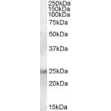 Western Blot - Anti-RAB8A Antibody (A84463) - Antibodies.com