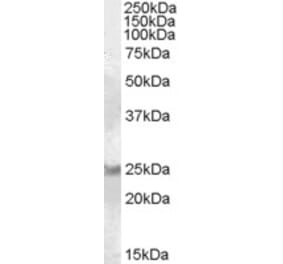 Western Blot - Anti-RAB8A Antibody (A84463) - Antibodies.com