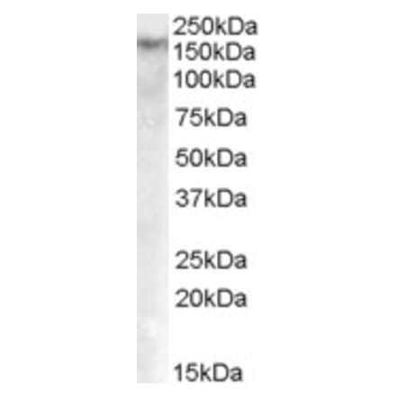 Western Blot - Anti-Dnmt1 Antibody (A84464) - Antibodies.com