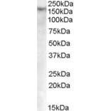 Western Blot - Anti-Dnmt1 Antibody (A84464) - Antibodies.com