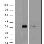 Western Blot - Anti-AKR1B10 Antibody (A84467) - Antibodies.com