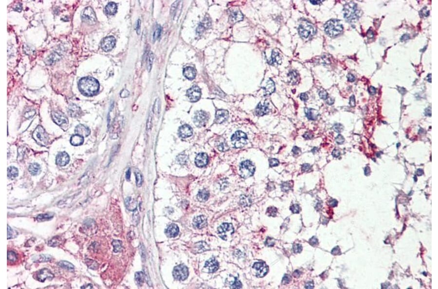 Immunohistochemistry - Anti-HRASLS Antibody (A84469) - Antibodies.com