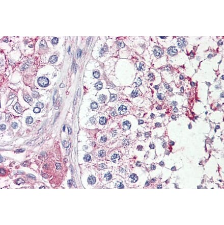 Immunohistochemistry - Anti-HRASLS Antibody (A84469) - Antibodies.com