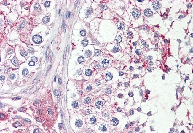 Anti-HRASLS Antibody (A84469) (3.75µg/ml) staining of paraffin embedded Human Testis. Steamed antigen retrieval with citrate buffer pH 6, AP-staining.