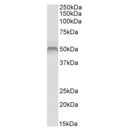 Western Blot - Anti-Fascin Antibody (A84470) - Antibodies.com