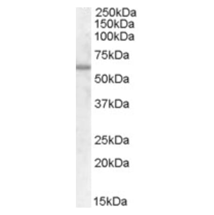 Western Blot - Anti-Frizzled 7 Antibody (A84471) - Antibodies.com