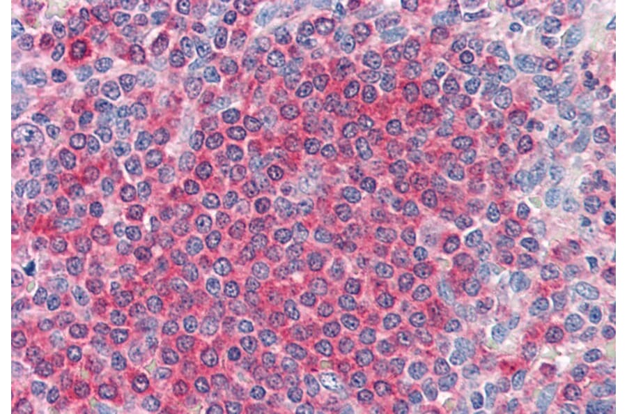 Immunohistochemistry - Anti-Frizzled 7 Antibody (A84471) - Antibodies.com