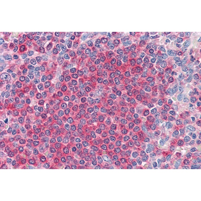 Immunohistochemistry - Anti-Frizzled 7 Antibody (A84471) - Antibodies.com