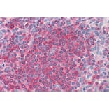 Immunohistochemistry - Anti-Frizzled 7 Antibody (A84471) - Antibodies.com