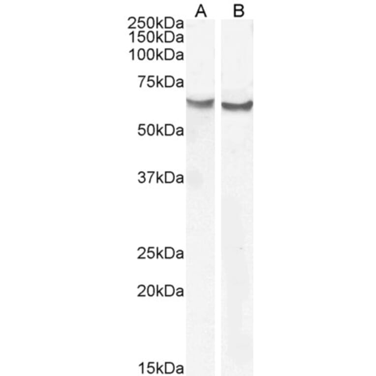 Western Blot - Anti-Frizzled 2/FZD2 Antibody (A84472) - Antibodies.com